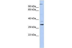Western Blotting (WB) image for anti-Actin Related Protein 2/3 Complex, Subunit 2, 34kDa (ARPC2) (N-Term) antibody (ABIN2787750)