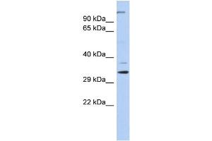 WB Suggested Anti-ARPC2 Antibody Titration: 0. (ARPC2 抗体  (N-Term))