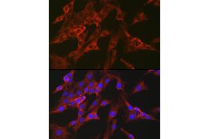 Immunofluorescence analysis of C6 cells using FBP1 Rabbit pAb (ABIN6130385, ABIN6140501, ABIN6140502 and ABIN6221054) at dilution of 1:100 (40x lens). (FBP1 抗体  (AA 1-338))