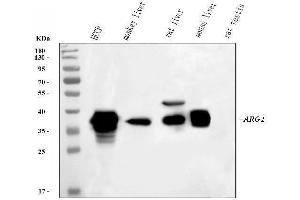 Western blot analysis of ARG1 using anti-ARG1 antibody (ABIN6719532).