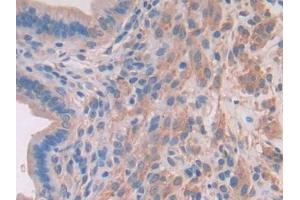 DAB staining on IHC-P; Samples: Mouse Uterus Tissue (MYLK2 抗体  (AA 330-548))