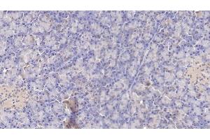 Immunohistochemistry (IHC) image for anti-Coagulation Factor III (thromboplastin, Tissue Factor) (F3) (AA 34-251) antibody (ABIN7426835)