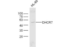 Human HL-60 cell lysates probed with Anti-DHCR7 Polyclonal Antibody, Unconjugated  at 1:300 overnight at 4˚C.