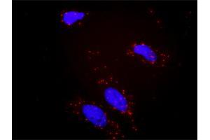 Proximity Ligation Analysis of protein-protein interactions between BCR and PIK3CG. (BCR 抗体  (AA 1-1076))