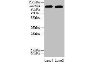 Western blot All lanes: ITGAL antibody at 8 μg/mL Lane 1: A549 whole cell lysate Lane 2: HepG2 whole cell lysate Secondary Goat polyclonal to rabbit IgG at 1/10000 dilution Predicted band size: 129, 135, 120 kDa Observed band size: 129 kDa (ITGAL 抗体  (AA 201-500))