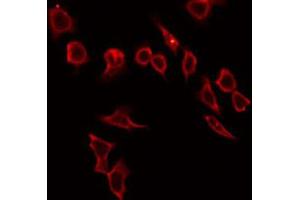 ABIN6272316 staining HeLa by IF/ICC. (HABP2 抗体  (Internal Region))