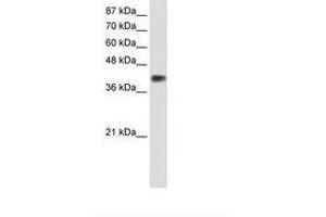 Image no. 1 for anti-Distal-Less Homeobox 3 (DLX3) (C-Term) antibody (ABIN202161) (DLX3 抗体  (C-Term))