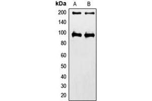 Western blot analysis of IGF1 Receptor expression in HeLa (A), MCF7 (B) whole cell lysates. (IGF1R 抗体  (C-Term))