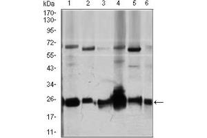 Western Blotting (WB) image for anti-rho GDP Dissociation Inhibitor (GDI) alpha (ARHGDIA) (AA 1-204) antibody (ABIN1844919) (ARHGDIA 抗体  (AA 1-204))