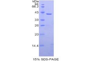 SDS-PAGE analysis of Human HIST1H2AB Protein. (HIST1H2AB 蛋白)