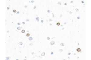 Immunocytochemistry (ICC) image for anti-Interleukin 9 (IL9) (AA 19-144) antibody (ABIN7795753) (Recombinant IL-9 抗体  (AA 19-144))