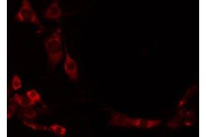 ABIN6274951 staining Hela by IF/ICC. (CHST1 抗体  (Internal Region))
