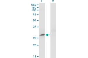 Western Blot analysis of CRYBB3 expression in transfected 293T cell line by CRYBB3 monoclonal antibody (M01), clone 4H6. (CRYBB3 抗体  (AA 112-211))