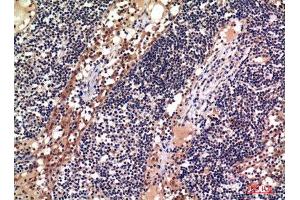 Immunohistochemistry (IHC) analysis of paraffin-embedded Human Lymph, antibody was diluted at 1:100. (ADAM10 抗体)