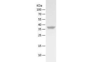 Western Blotting (WB) image for Aminolevulinate Dehydratase (ALAD) (AA 1-354) protein (His tag) (ABIN7285374) (ALAD Protein (AA 1-354) (His tag))