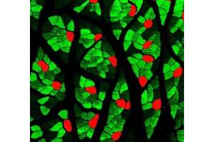 Immunofluorescent analysis of paraformaldehyde-fixed rat skeletal muscle using MYH1 (, red ) and MYH7 (ABIN7075623, green ) at dilution of 1: 1000
