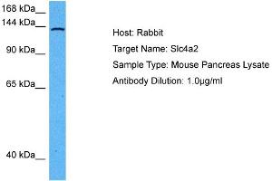 Western Blotting (WB) image for anti-Solute Carrier Family 4, Anion Exchanger, Member 2 (erythrocyte Membrane Protein Band 3-Like 1) (SLC4A2) (N-Term) antibody (ABIN2781578)