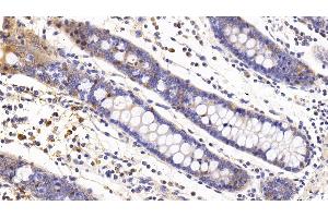 Detection of IL6 in Human Colon Tissue using Monoclonal Antibody to Interleukin 6 (IL6) (IL-6 抗体  (AA 29-212))