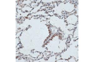 Immunohistochemistry of paraffin-embedded mouse lung using PMEP antibody (6555) at dilution of 1:100 (40x lens). (PMEPA1 抗体  (AA 173-252))