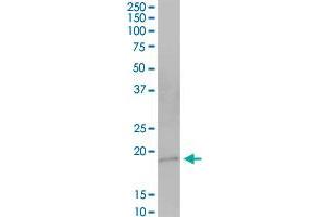 HSPC159 MaxPab polyclonal antibody. (GRP 抗体  (AA 1-172))