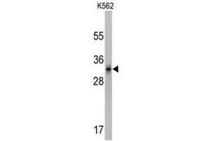 Image no. 1 for anti-Calcium Channel, Voltage-Dependent, gamma Subunit 5 (CACNG5) (C-Term) antibody (ABIN452794) (CACNG5 抗体  (C-Term))