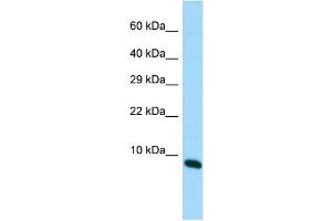 Host: Rabbit Target Name: MIR22HG Sample Type: Fetal Brain lysates Antibody Dilution: 1. (MIR22HG 抗体  (C-Term))