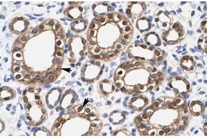 Immunohistochemistry (IHC) image for anti-Enolase 1 (ENO1) (Middle Region) antibody (ABIN2775758)