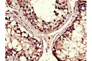 Immunohistochemistry of paraffin-embedded human testis tissue using ABIN7149312 at dilution of 1:100 (DYNC1H1 抗体  (AA 12-66))