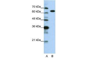 WB Suggested Anti-KARS  Antibody Titration: 0. (KARS 抗体  (C-Term))