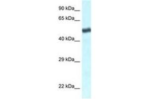 Image no. 1 for anti-Transducin (Beta)-Like 1 X-Linked Receptor 1 (TBL1XR1) (C-Term) antibody (ABIN6747500) (TBL1XR1 抗体  (C-Term))