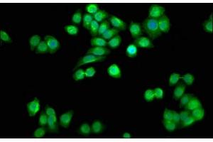 Immunofluorescence staining of PC-3 cells with ABIN7168295 at 1:33, counter-stained with DAPI. (SSU72 抗体  (C-Term))