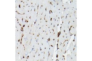Immunohistochemistry (IHC) image for anti-Apolipoprotein E (APOE) (AA 200-300) antibody (ABIN6137017)