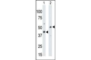 The anti-CKMT1 Pab (ABIN391091 and ABIN2841231) is used in Western blot to detect CKMT1 in mouse colon tissue lysate (Lane 1) and ZR-75-1 cell lysate (Lane 2). (CKMT1 抗体  (N-Term))