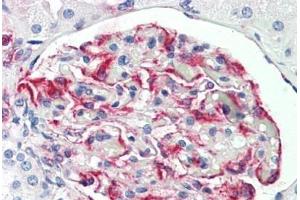 anti-Pseudopodium-Enriched Atypical Kinase 1 (PEAK1) (AA 673-699) antibody