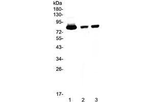 Western blot testing of 1) human placenta, 2) rat spleen and 3) mouse spleen tissue lysate with Lactoferrin antibody at 0. (Lactoferrin 抗体)