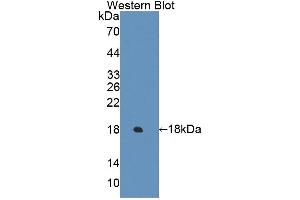 Detection of Recombinant ECRG4, Human using Polyclonal Antibody to Esophageal Cancer Related Gene 4 (ECRG4) (Esophageal Cancer Related Gene 4 (AA 32-148) 抗体)