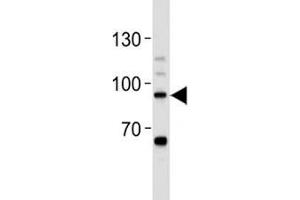 Western Blotting (WB) image for anti-Signal Transducer and Activator of Transcription 3 (Acute-Phase Response Factor) (STAT3) (AA 711-743) antibody (ABIN3032569)