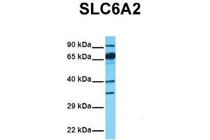 Western Blotting (WB) image for anti-Solute Carrier Family 6 (Neurotransmitter Transporter, Noradrenalin), Member 2 (SLC6A2) (Middle Region) antibody (ABIN2777051)