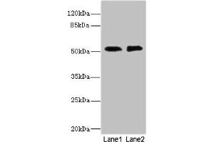 Western blot All lanes: TMOD1 antibody at 2. (CIR1 抗体  (AA 1-160))