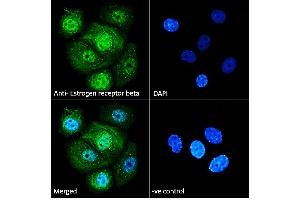 ABIN5539801 Immunofluorescence analysis of paraformaldehyde fixed MCF7 cells, permeabilized with 0. (ESR2 抗体  (AA 417-428))