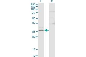 Western Blot analysis of CTRB1 expression in transfected 293T cell line by CTRB1 monoclonal antibody (M02), clone 3C8. (CTRB1 抗体  (AA 101-200))