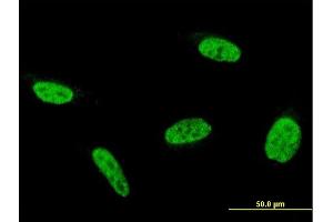 Immunofluorescence of monoclonal antibody to C9orf86 on HeLa cell. (C9orf86 抗体  (AA 1-477))