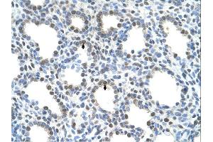 Immunohistochemistry (IHC) image for anti-Solute Carrier Family 15 (H+/Peptide Transporter), Member 4 (SLC15A4) (N-Term) antibody (ABIN2781719) (SLC15A4 抗体  (N-Term))