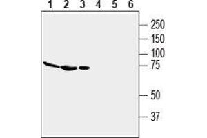 Western blot analysis of mouse brain membranes (lanes 1 and 4), rat brain lysate (lanes 2 and 5) and rat spleen membranes (lanes 3 and 6): - 1-3.