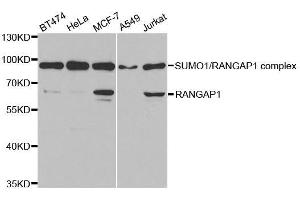 Western blot analysis of extracts of various cell lines, using RANGAP1 antibody. (RANGAP1 抗体  (AA 398-587))
