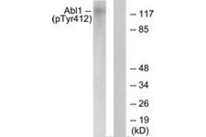 Western blot analysis of extracts from COS7 cells treated with Adriamycin 0. (ABL1 抗体  (pTyr393))