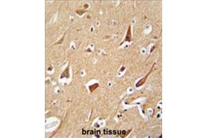 Immunohistochemistry (Paraffin-embedded Sections) (IHC (p)) image for anti-Zinc Finger, FYVE Domain Containing 28 (ZFYVE28) (AA 611-642), (C-Term) antibody (ABIN955668)