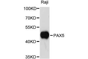 Western blot analysis of extracts of Raji cells, using PAX5 antibody (ABIN1874048) at 1:3000 dilution. (PAX5 抗体)