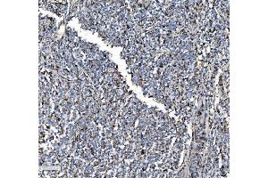 IHC analysis of P4HB using anti-P4HB antibody (ABIN7600075). (P4HB 抗体  (AA 146-363))