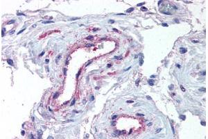 Human Testis, Vessels (formalin-fixed, paraffin-embedded) stained with ADAMTS1 antibody ABIN625843 at 5 ug/ml followed by biotinylated goat anti-rabbit IgG secondary antibody ABIN481713, alkaline phosphatase-streptavidin and chromogen. (ADAMTS1 抗体  (N-Term))
